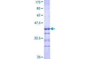 Image no. 1 for Microtubule-Associated Protein 1 Light Chain 3 beta (MAP1LC3B) (AA 1-71) protein (GST tag) (ABIN1310158)