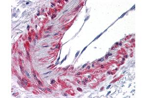 Anti-TBXA2R antibody IHC of human vessel. (TBXA2R antibody  (AA 1-15))