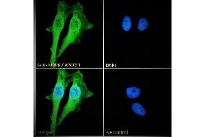(ABIN302164) Immunofluorescence analysis of paraformaldehyde fixed HeLa cells, permeabilized with 0. (ABCC11 antibody  (Internal Region))