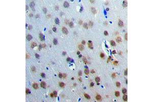 Immunohistochemical analysis of CAMKV staining in human brain formalin fixed paraffin embedded tissue section. (CAMKV antibody  (Center))