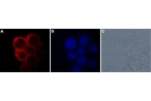 Expression of TRPM7 in GH3 cell lines - Immunocytochemical staining of GH3 cells with Anti-TRPM7 Antibody (ABIN7043836, ABIN7044014 and ABIN7044015), (1:100), followed by goat anti-rabbit-AlexaFluor-550 secondary antibody (A).