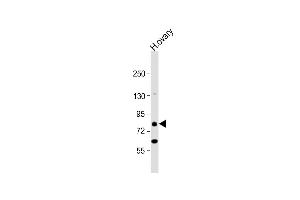 Anti-DDX4 Antibody (C-term) at 1:1000 dilution + human ovary lysate Lysates/proteins at 20 μg per lane.