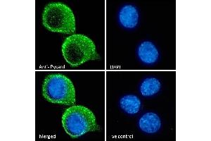 ABIN1590015 Immunofluorescence analysis of paraformaldehyde fixed KNRK cells, permeabilized with 0. (PYCARD antibody  (Internal Region))