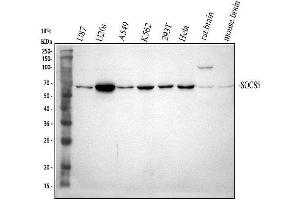 Western blot analysis of SOCS5 using anti-SOCS5 antibody (ABIN7601562). (SOCS5 antibody  (AA 386-536))