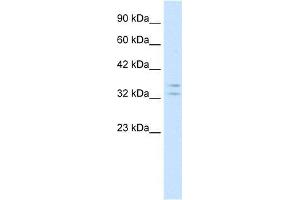Human Jurkat; WB Suggested Anti-POU1F1 Antibody Titration: 1. (POU1F1 antibody  (N-Term))