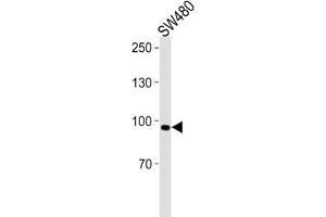 Western Blotting (WB) image for anti-Anoctamin 6 (ANO6) antibody (ABIN3001398) (Anoctamin 6 antibody)