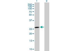 Western Blot analysis of FLJ37201 expression in transfected 293T cell line by FLJ37201 MaxPab polyclonal antibody.