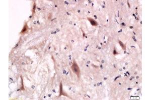 Formalin-fixed and paraffin embedded rat anterior horn of spinal cord labeled with Anti-P2Y12 Polyclonal Antibody, Unconjugated  at 1:200 followed by conjugation to the secondary antibody and DAB staining. (P2RY12 antibody  (AA 141-240))