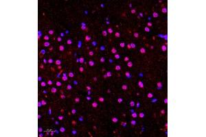 Immunofluorescence of paraffin embedded rat brain using Hes2 (ABIN7074158) at dilution of 1:100 (400x lens) (HES2 antibody)