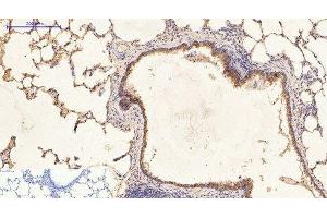 Immunohistochemistry of paraffin-embedded Rat lung tissue using CK-16 Monoclonal Antibody at dilution of 1:200. (KRT16 antibody)