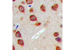 Immunohistochemical analysis of WASF3 staining in human brain formalin fixed paraffin embedded tissue section. (WASF3 antibody  (Center))