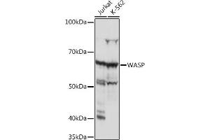 Western blot analysis of extracts of various cell lines, using WASP Rabbit mAb (ABIN7271381) at 1:1000 dilution. (WASP antibody)