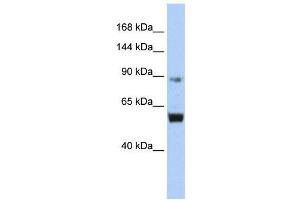 WB Suggested Anti-MCM10  Antibody Titration: 0. (MCM10 antibody  (Middle Region))