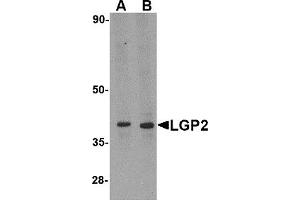Western Blotting (WB) image for anti-DEXH (Asp-Glu-X-His) Box Polypeptide 58 (DHX58) (N-Term) antibody (ABIN1031441) (DHX58 antibody  (N-Term))