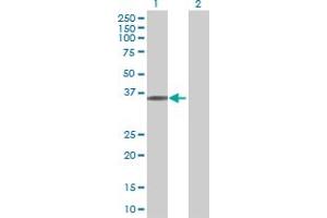 Western Blot analysis of UBR7 expression in transfected 293T cell line ( H00055148-T01 ) by UBR7 MaxPab polyclonal antibody. (UBR7 antibody  (AA 1-274))