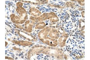 GMPPB antibody was used for immunohistochemistry at a concentration of 4-8 ug/ml to stain Epithelial cells of renal tubule (arrows) in Human Kidney. (GMPPB antibody  (C-Term))
