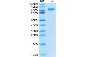 Cynomolgus Her2 on Tris-Bis PAGE under reduced condition. (ErbB2/Her2 Protein (AA 23-652) (His tag))