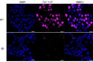Immunocytochemical staining of HeLa cells using Cyclin e2 antibody (ABIN7798199), 1:1,000), Top panel: wild-type (WT), Bottom panal: Cyclin e2 shRNA knockdown (KD).