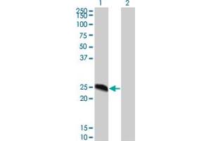 Western Blot analysis of MGC16186 expression in transfected 293T cell line by MGC16186 monoclonal antibody (M02), clone 8G4. (DYDC2 antibody  (AA 1-177))