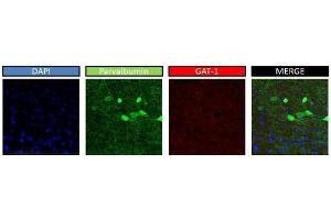 mouse brain (SLC6A1 antibody  (Middle Region))