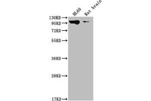 Western Blot Positive WB detected in: HL60 whole cell lysate, Rat brain tissue All lanes: DNM2 antibody at 1:2000 Secondary Goat polyclonal to rabbit IgG at 1/50000 dilution Predicted band size: 99, 98 kDa Observed band size: 99 kDa (Recombinant DNM2 antibody)