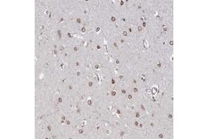 Immunohistochemical staining of human cerebral cortex with NUP155 polyclonal antibody  shows moderate nuclear membrane positivity in neuronal cells at 1:10-1:20 dilution. (NUP155 antibody)