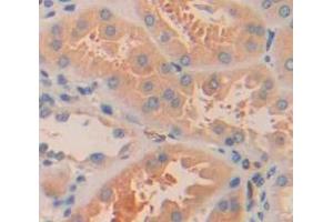 Used in DAB staining on fromalin fixed paraffin- embedded Kidney tissue (ARL15 antibody  (AA 1-204))