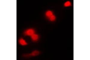 Immunofluorescent analysis of CDC2 staining in K562 cells. (CDK1 antibody  (Center))