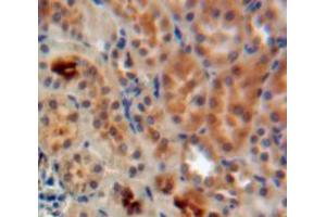 Used in DAB staining on fromalin fixed paraffin-embedded Kidney tissue (ADAP1 antibody  (AA 45-356))