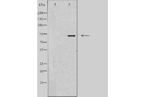 Western blot analysis of extracts from Jurkat cells using FSHR antibody. (FSHR antibody  (Internal Region))