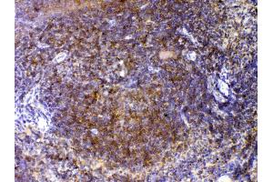 IHC analysis of CTLA4 using anti-CTLA4 antibody . (CTLA4 antibody  (AA 36-161))