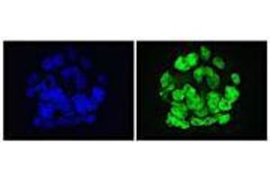 GLIS1 antibody (mAb) tested by Immunofluorescence. (GLIS1 antibody)