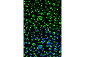 Immunofluorescence analysis of HeLa cells using P4HB antibody (ABIN5970266). (P4HB antibody)