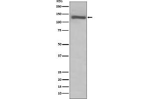 Western blot analysis of TLR7 expression in Raji cell lysate.