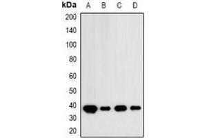 Western blot analysis of IDH3 alpha expression in MCF7 (A), HT29 (B), mouse brain (C), mouse kidney (D) whole cell lysates.