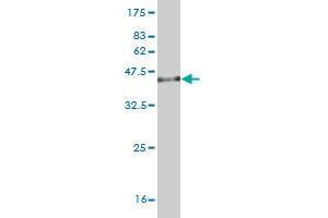 Western Blotting (WB) image for anti-Cell Death-Inducing DFFA-Like Effector B (CIDEB) (AA 3-110) antibody (ABIN565343)
