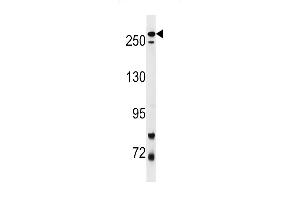 Park8 (LRRK2) Antibody  f western blot analysis in mouse lung tissue lysates (35 μg/lane). (LRRK2 antibody  (AA 878-909))