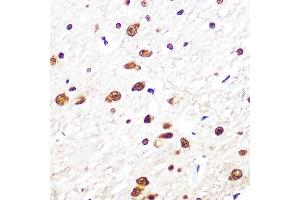Immunohistochemistry of paraffin-embedded rat brain using SRSF1/SRSF1/SF2/ASF Rabbit mAb (ABIN7270213) at dilution of 1:100 (40x lens). (SRSF1 antibody)