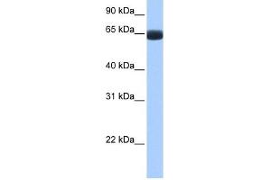ARHGAP28 antibody used at 1 ug/ml to detect target protein. (ARHGAP28 antibody  (C-Term))