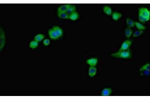 Immunofluorescent analysis of HepG2 cells using ABIN7156203 at dilution of 1:100 and Alexa Fluor 488-congugated AffiniPure Goat Anti-Rabbit IgG(H+L) (Indian Hedgehog antibody  (AA 203-411))