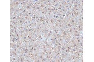Immunohistochemistry of paraffin-embedded Rat liver using SNW1 Polyclonal Antibody at dilution of 1:100 (40x lens). (SNW1 antibody)