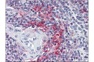 Human Spleen (formalin-fixed, paraffin-embedded) stained with VAV3at 5 µg/ml followed by biotinylated anti-goat IgG secondary antibody, alkaline phosphatase-streptavidin and chromogen. (VAV3 antibody  (Internal Region))