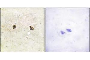 Immunohistochemistry analysis of paraffin-embedded human brain tissue, using EPHB1/2 (Ab-594/604) Antibody. (EPHB1/2 antibody  (AA 561-610))