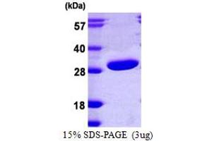SDS-PAGE (SDS) image for phosphoribosyl Transferase Domain Containing 1 (PRTFDC1) (AA 1-225) protein (His tag) (ABIN667475) (PRTFDC1 Protein (AA 1-225) (His tag))