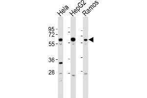 All lanes : Anti-GRK5 Antibody  at 1:2000 dilution Lane 1: Hela whole cell lysates Lane 2: HepG2 whole cell lysates Lane 3: Ramos whole cell lysates Lysates/proteins at 20 μg per lane. (GRK5 antibody  (C-Term))
