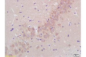 Formalin-fixed and paraffin embedded rat brain labeled with Rabbit Anti Aggrecanase-2/ADAMTS5 Polyclonal Antibody, Unconjugated (ABIN701005) at 1:200 followed by conjugation to the secondary antibody and DAB staining (ADAMTS5 antibody  (AA 511-610))