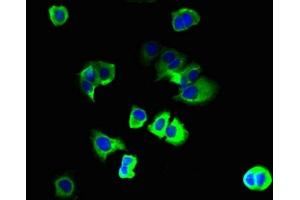 Immunofluorescent analysis of MCF-7 cells using ABIN7163816 at dilution of 1:100 and Alexa Fluor 488-congugated AffiniPure Goat Anti-Rabbit IgG(H+L) (PKD2L2 antibody  (AA 390-523))