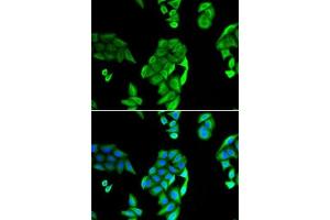 Immunofluorescence analysis of U2OS cells using NOL3 antibody (ABIN6132415, ABIN6144704, ABIN6144706 and ABIN6221927). (NOL3 antibody  (AA 1-208))