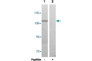 Western blot analysis of extracts from HUVEC cells, using COL20A1 polyclonal antibody .