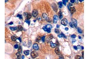 DAB staining on IHC-P; Samples: Mouse Colon Tissue (Glutathione Synthetase antibody  (AA 270-474))